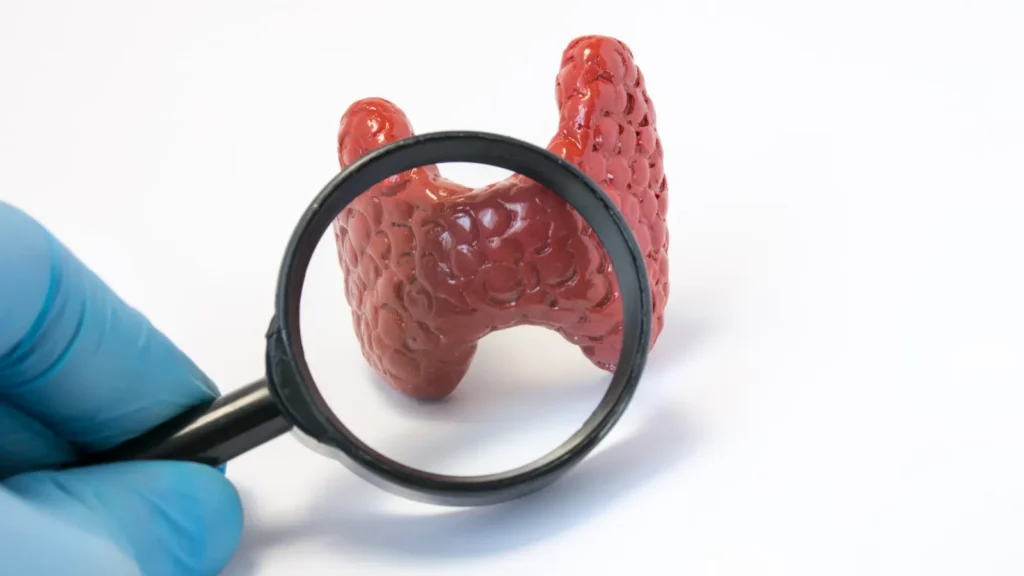 Hypothyroidism vs. Hashimoto’s: What’s the Difference?
