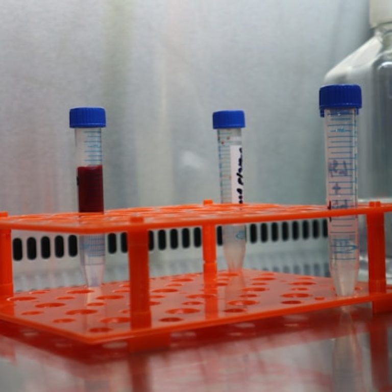 lab results 1